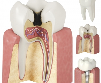 现代牙齿，牙科诊所器材-ID:510191924